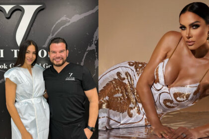 Dr Vitto realizo una intervención estética a BárbaraDr Vitto realizo una intervención estética a Bárbara